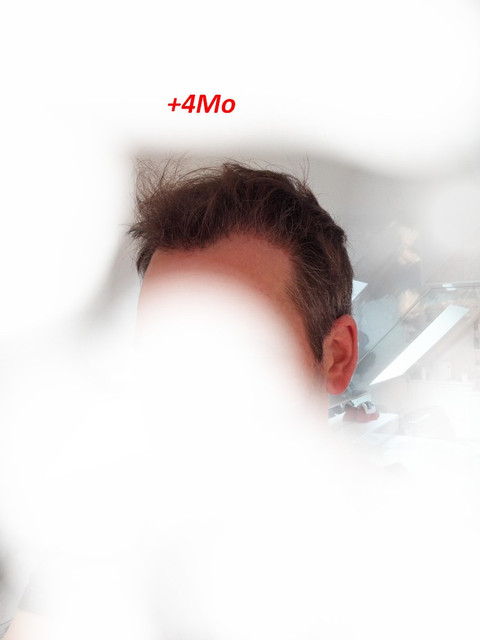 4Mo-3.jpg