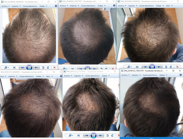 pelo
