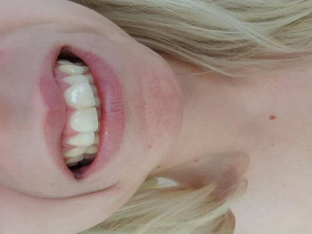 20180709 112202
