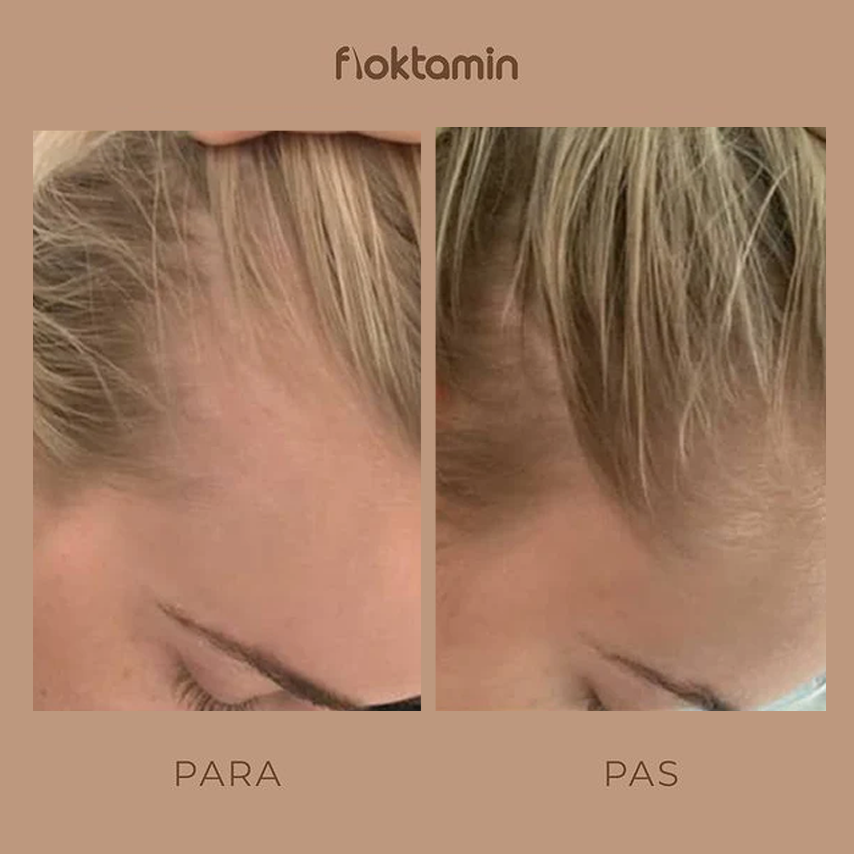 Floktamin Rezultati 3