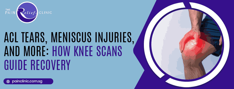 ACL Tears Meniscus Injuries and More How Knee Scans Guide Recovery
