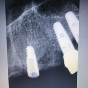 IMG-dc4e3d95b6fe9c8193312f010139db5e-V.j