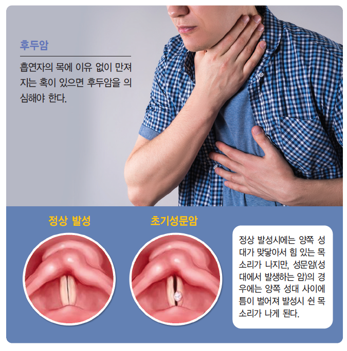 목소리 변화