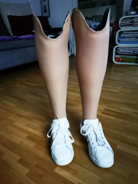 Beinprothesen.webp