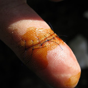 CUT-FINGER