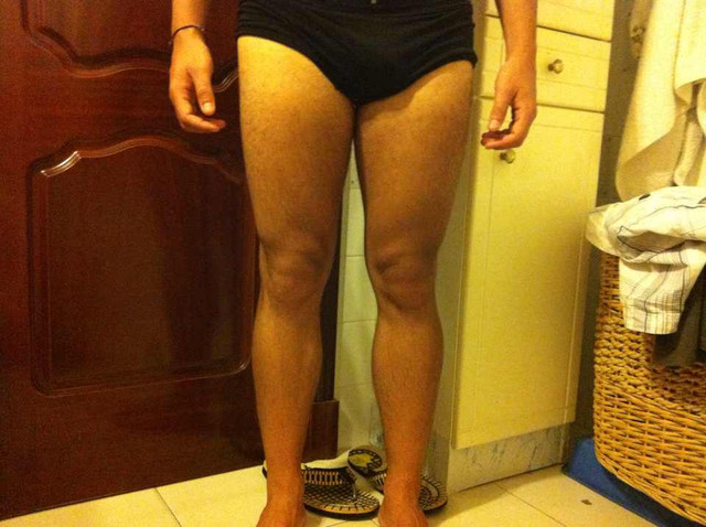 pierna1
