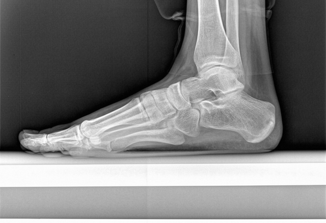 foot side.png