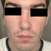 post-revision-front