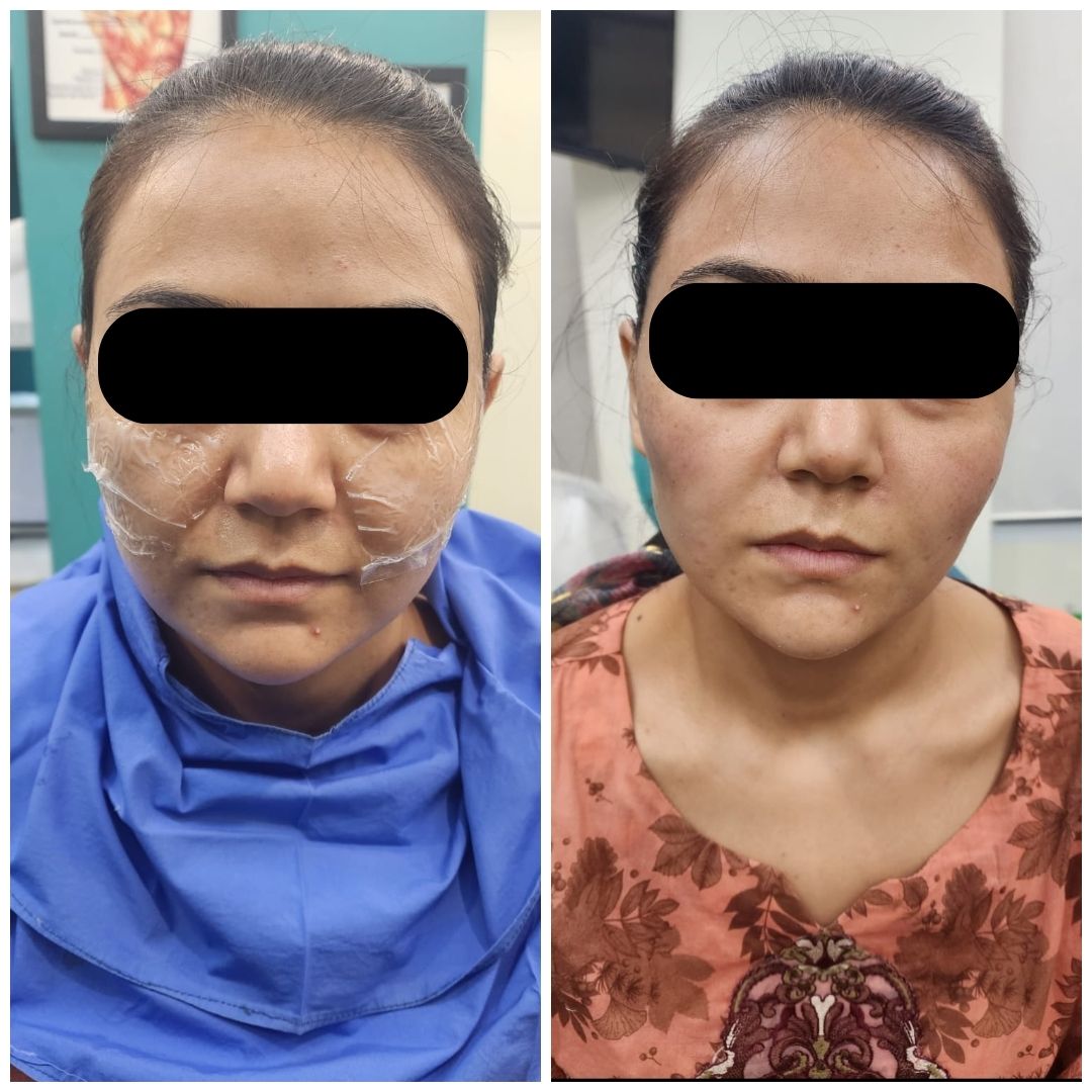 Real patient result