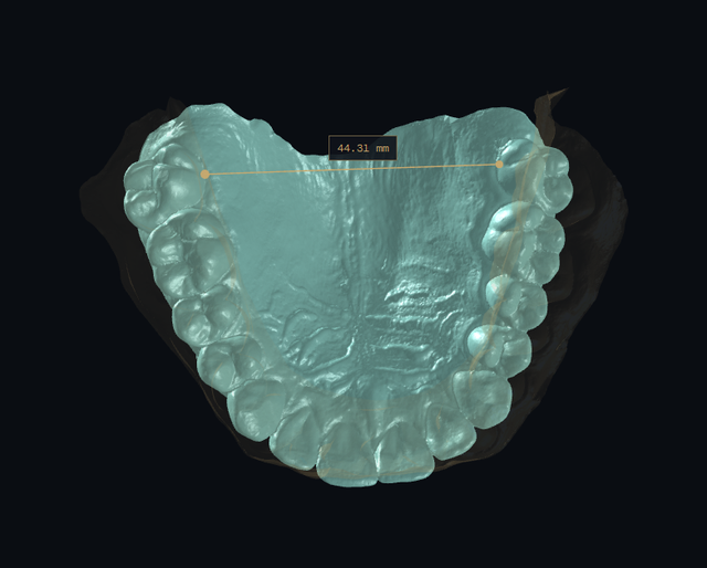 occlusion 12.png