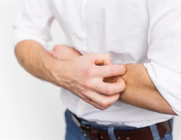 Clarifying the Misdiagnosis of Steroid-Induced Facial Skin Conditions