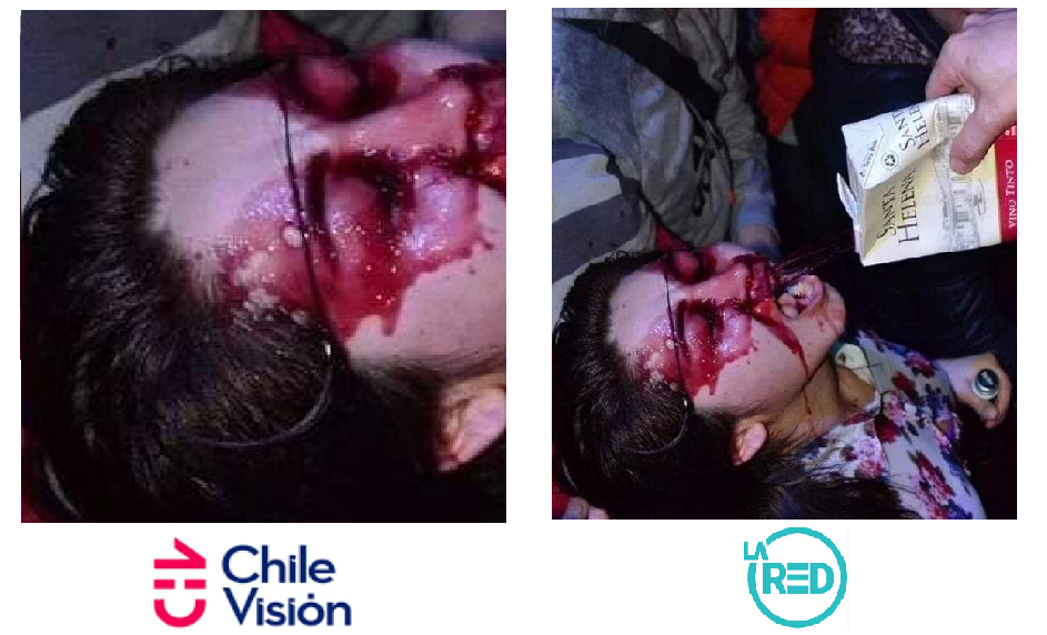 curaguilla.png