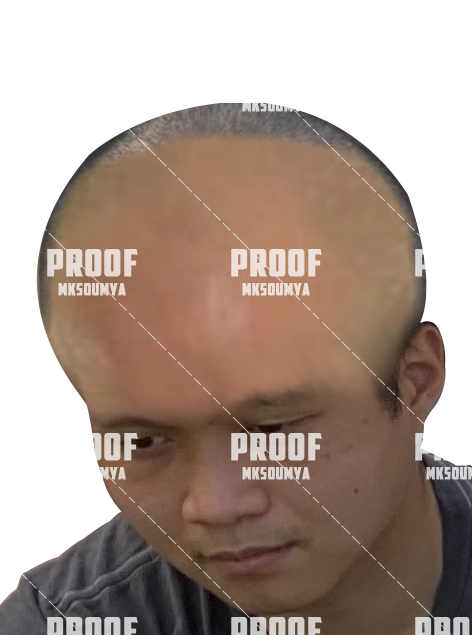 2bald.png