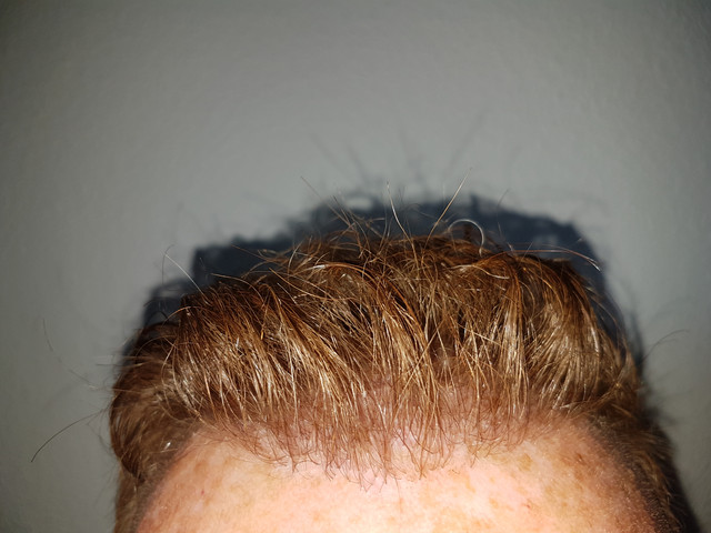 20170901 195546
