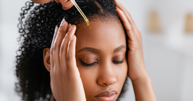 Postpartum hair loss in Black women