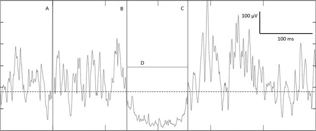 Figure-1