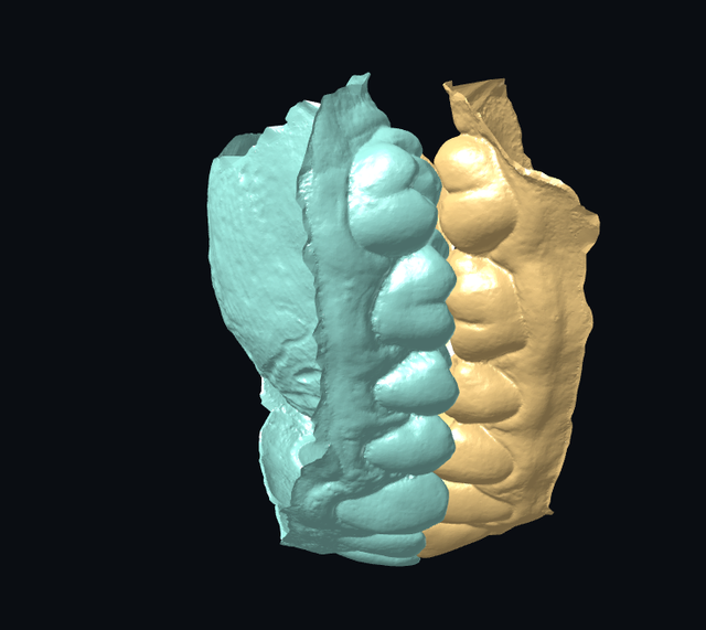 occlusion 6.png
