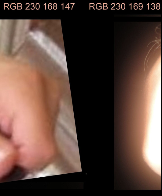 skin2