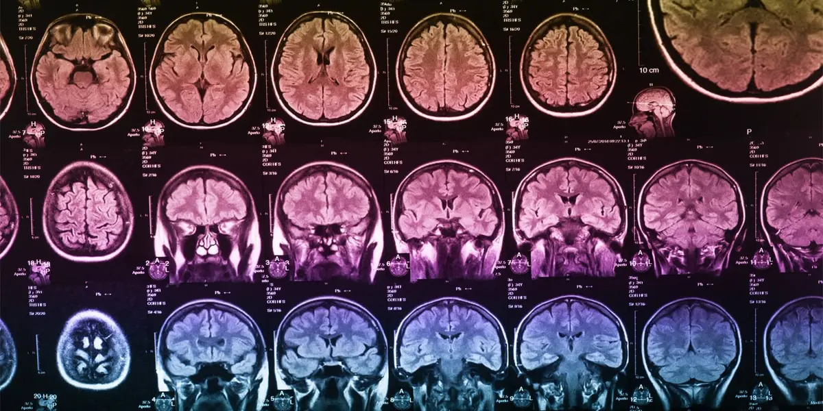 Air Pollution Linked to Memory Decline in Black Adults
