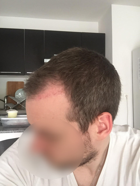 M2 3