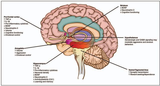 brainaae