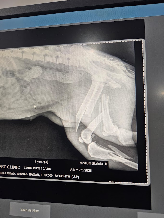 Chai X-ray showing fractures