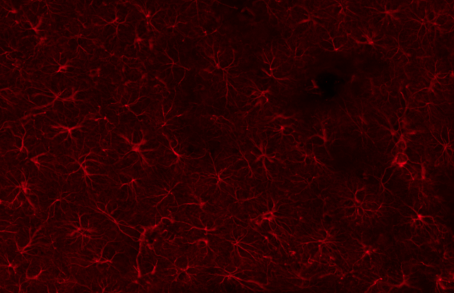 gfap-stained-astrocytes