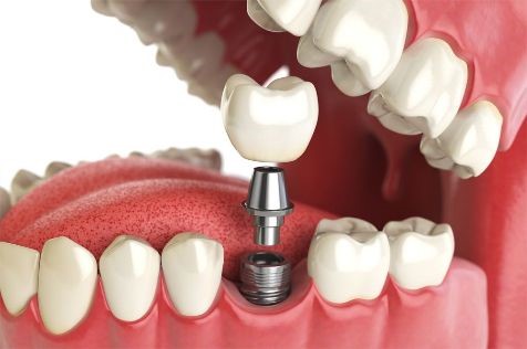 Dr Paulo Pinho Oral Surgery Clinic