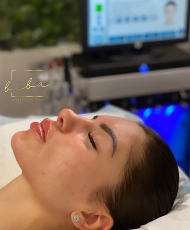 Hydrafacial-Parramatta
