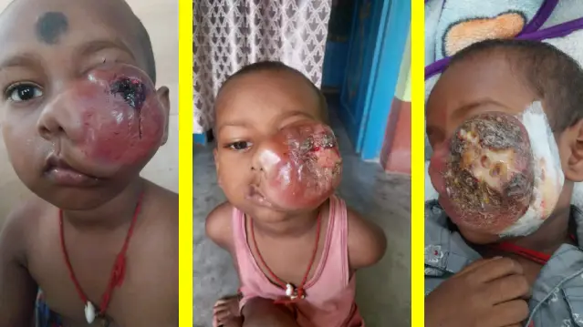 Help 3-Year-Old Barun Roy Fight Cancer - Image 1