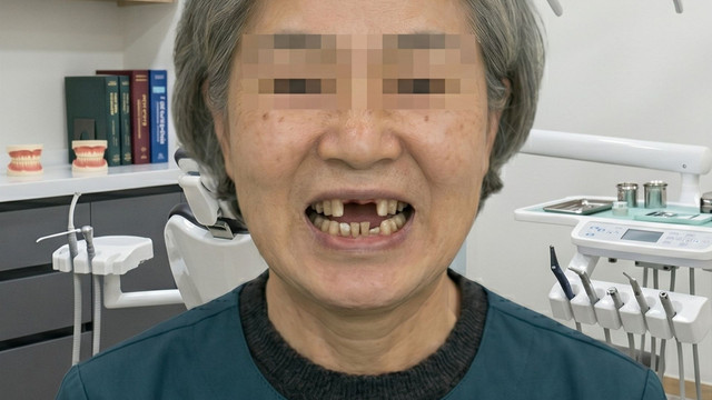수술 전