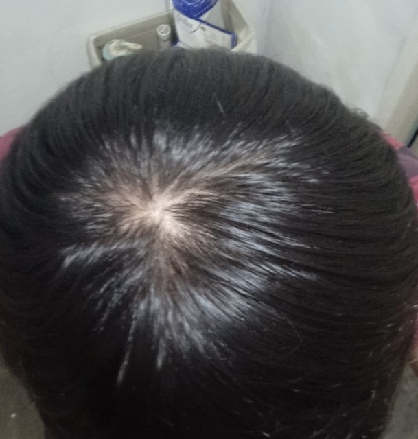 cabello