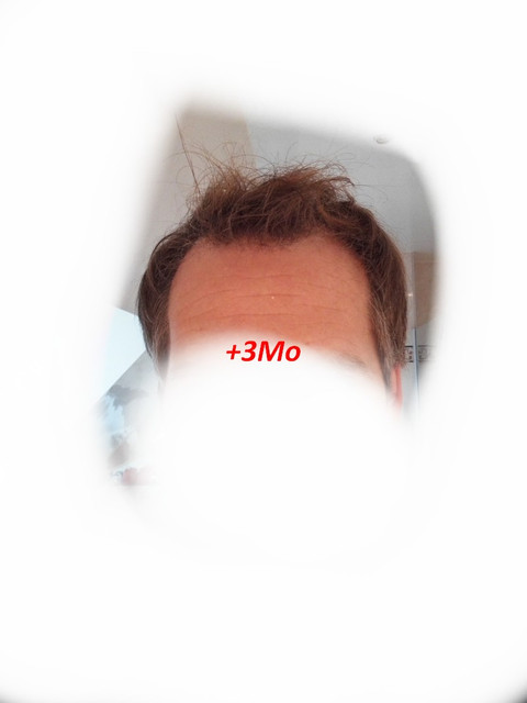 3Mo-1.jpg