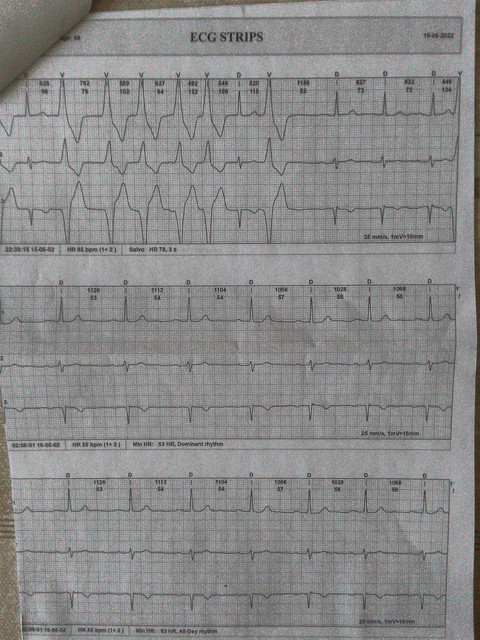 EKG-4