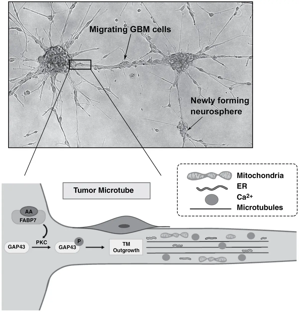 Brain Cancer Infiltration Mechanism Inhibited