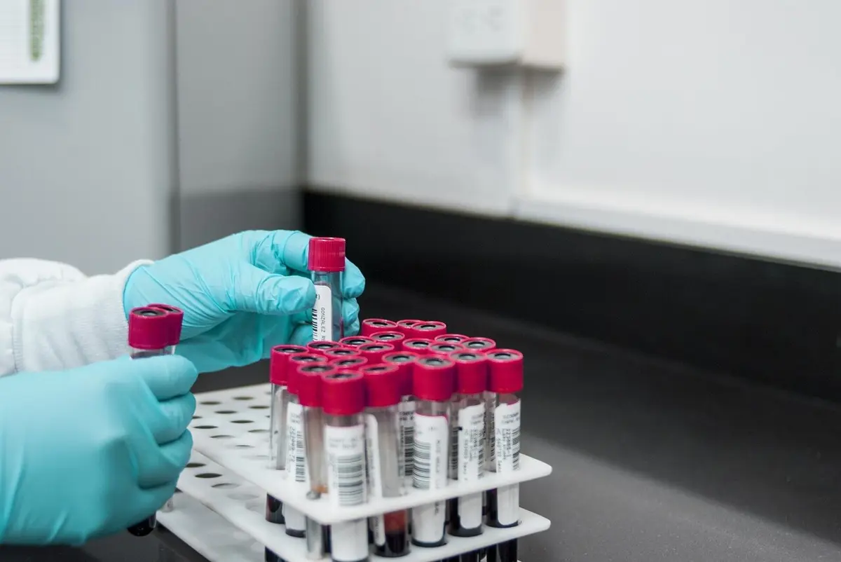 New Blood Biomarkers Offer Hope for Early Detection of Alzheimer's Disease