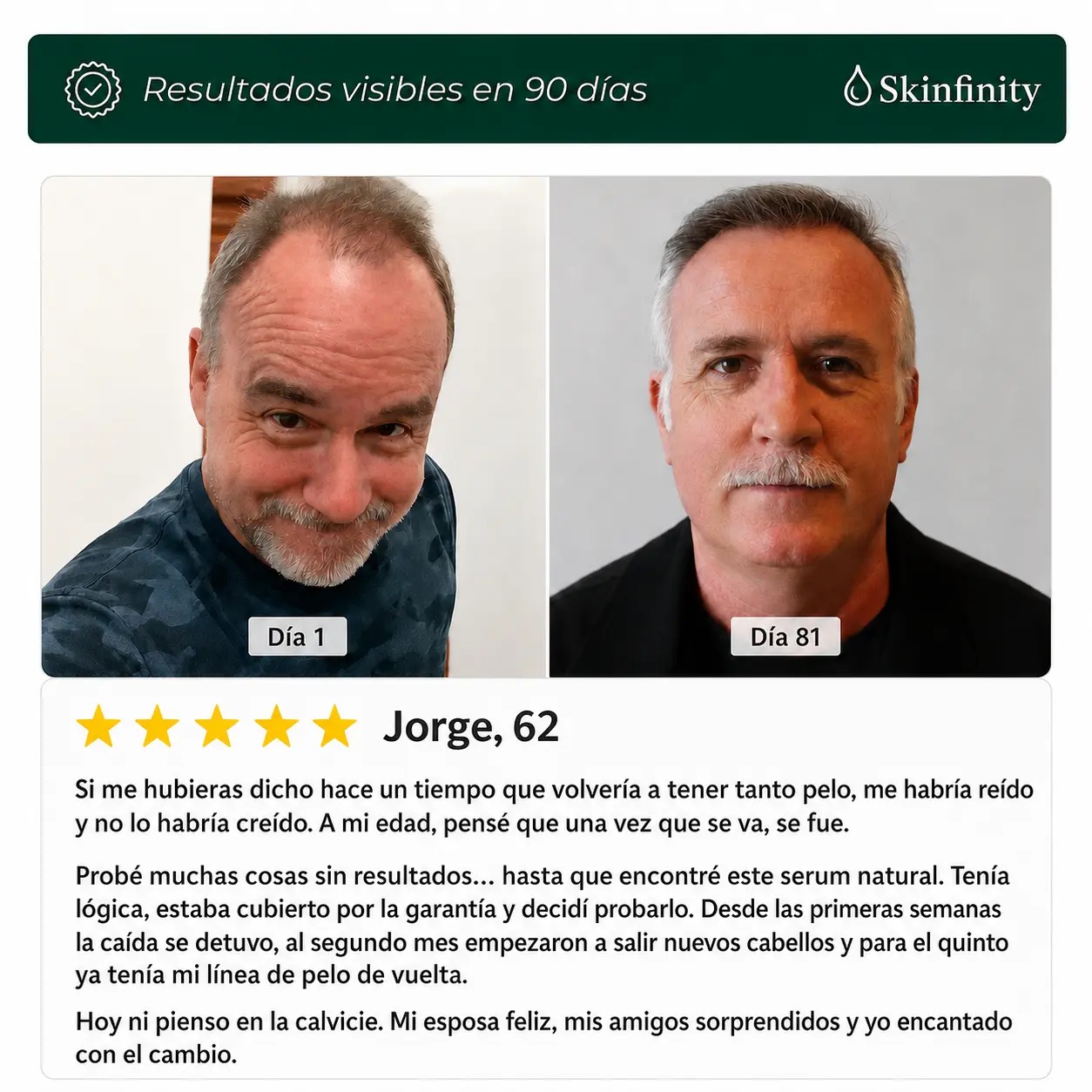 Resultado capilar despu&eacute;s de liberar el fol&iacute;culo