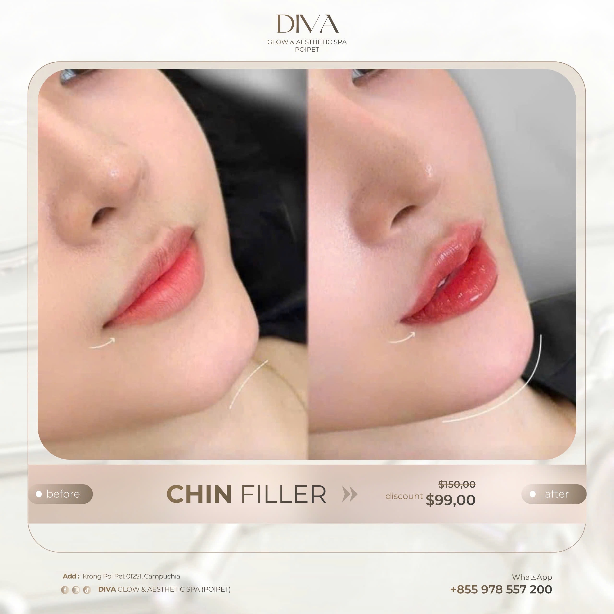 DIVA Skin Clinic Poipet