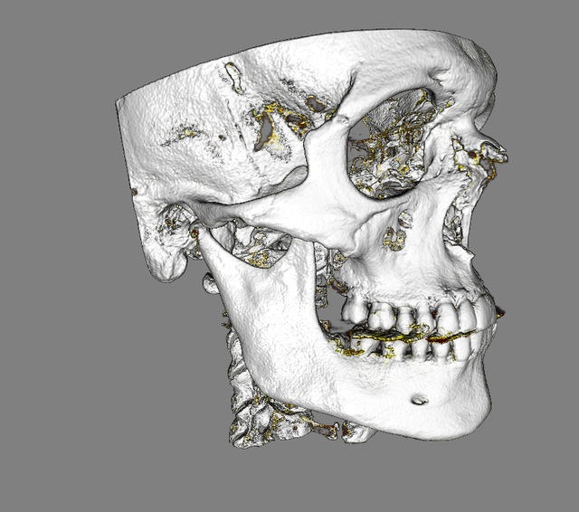 skull r side.png