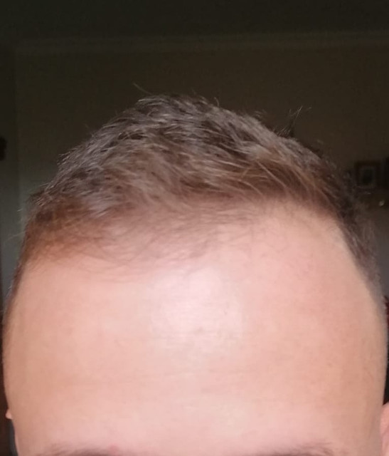 Frontal