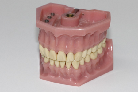 Best-Dentures-In-Sydney