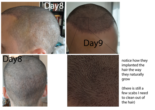 Day8-01