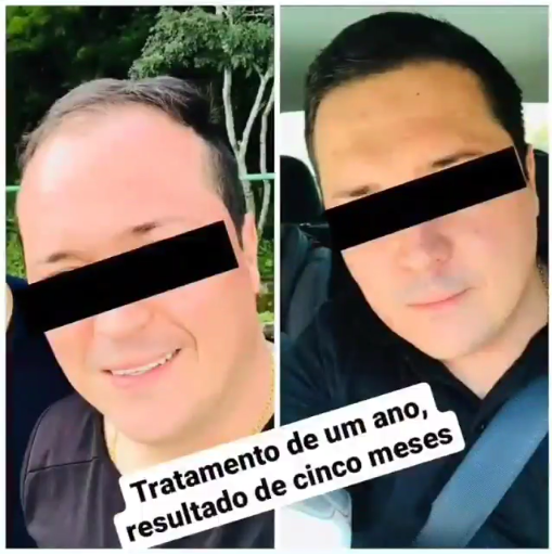 Resultado cliente 2 — Complexo Capilar Primordial Farma