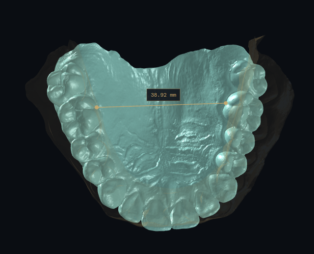 occlusion 11.png