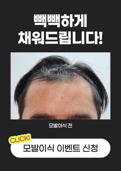 모발이식 이벤트 신청