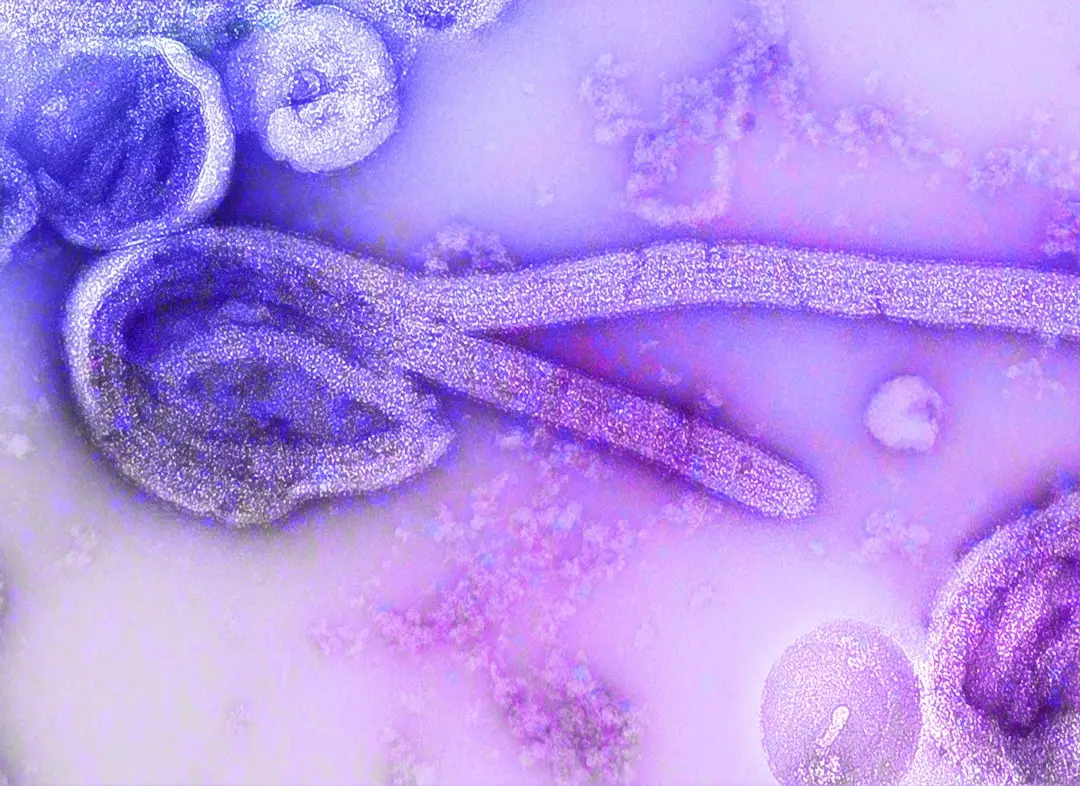 Cyclospora Outbreak Linked to Widespread Food Contamination