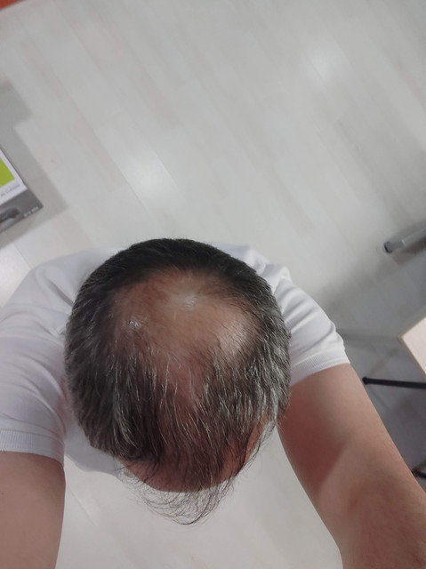 IMG-20190708-182847-1