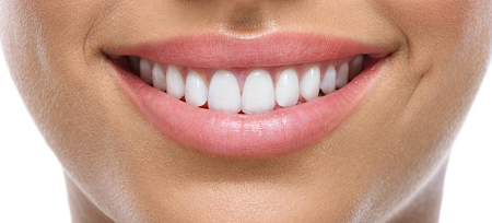 invisible braces sydney Invisible-Braces-Sydney