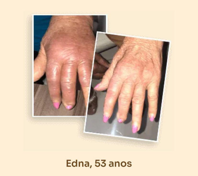 Edna, 53 anos