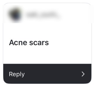 Story reply